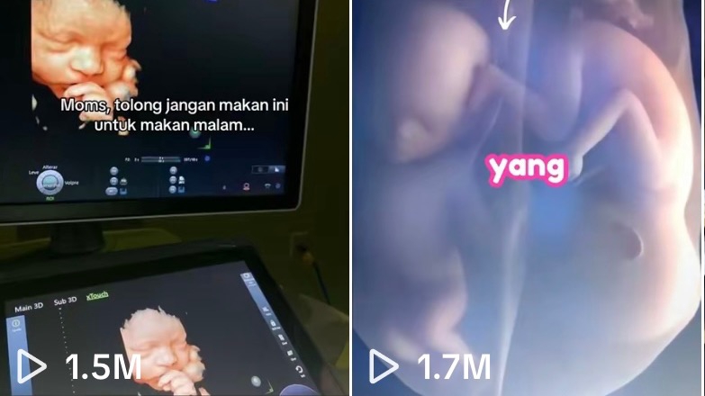 Jasa Content Creator untuk TikTok, Instagram, YouTube - Pembuatan Konten Viral