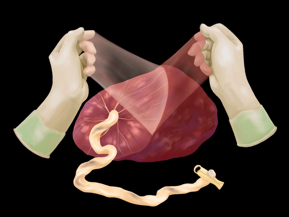 Gambar dan Ilustrasi - Ilustrasi Medis, Sains/Saintifik, Kedokteran dan Kesehatan - 4