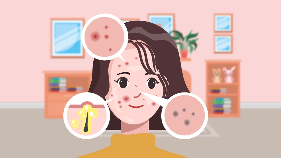 Motion Graphics - Jasa Video Animasi 2D | Motion Graphic | Video Explainer | Revisi Unlimited & Free Voice Over - 14